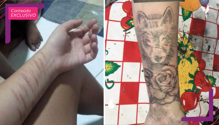 tatuadores transformar cicatrizes automutilacao arte