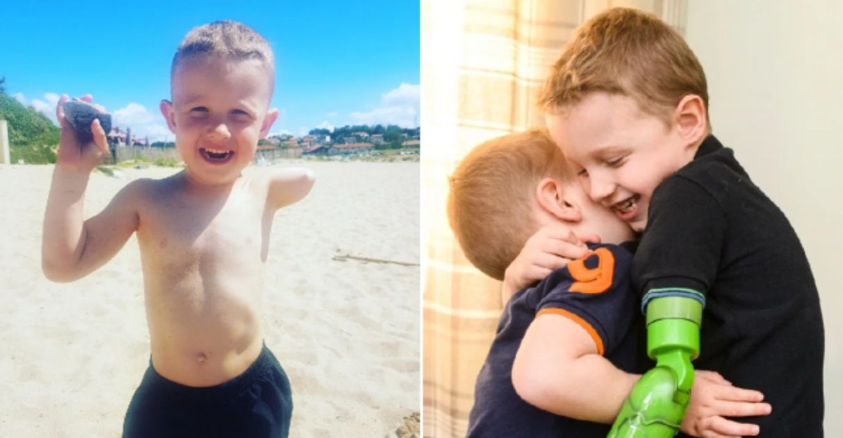 menino ganha braço protético abraça irmão