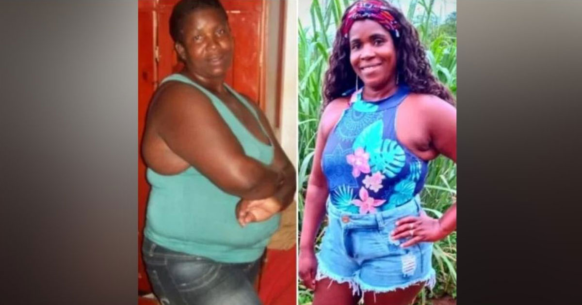 Mulher em antes e depois de perder peso