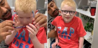 menino albino com retina albina ganha óculos especiais e enxerga pela primeira vez