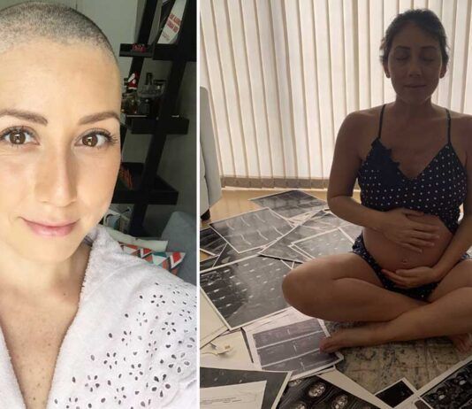 mulher diagnosticada com câncer de mama com a cabeça raspada